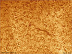 sun2007apr02 0841 dbvt